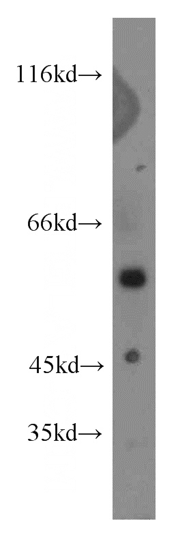 rat lymph tissue were subjected to SDS PAGE followed by western blot with Catalog No:113869(PIK3R5 antibody) at dilution of 1:300