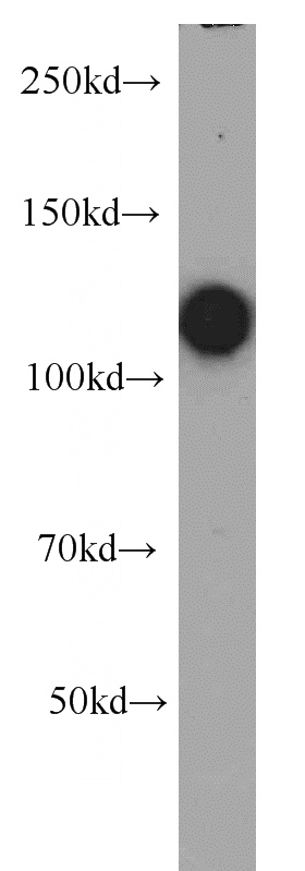 Jurkat cells were subjected to SDS PAGE followed by western blot with Catalog No:114489(RB1 antibody) at dilution of 1:3000