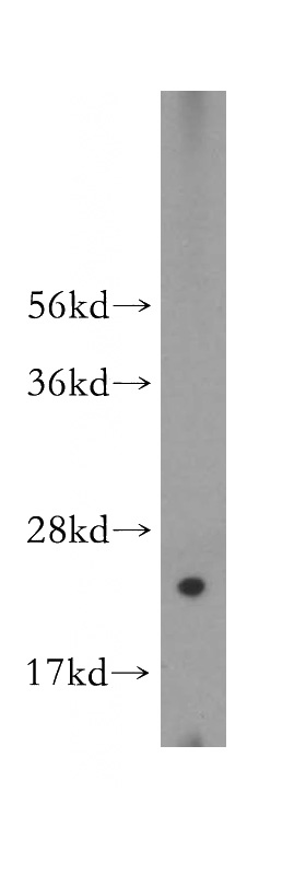 HeLa cells were subjected to SDS PAGE followed by western blot with Catalog No:114882(RPL26L1 antibody) at dilution of 1:500