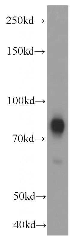 human brain tissue were subjected to SDS PAGE followed by western blot with Catalog No:107646(TRPC4AP antibody) at dilution of 1:1000