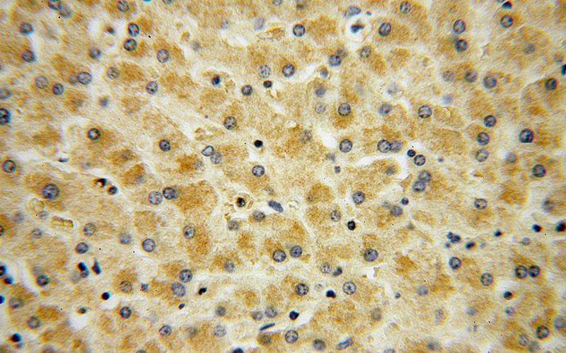 Immunohistochemical of paraffin-embedded human liver using Catalog No:114365(PC antibody) at dilution of 1:50 (under 40x lens)