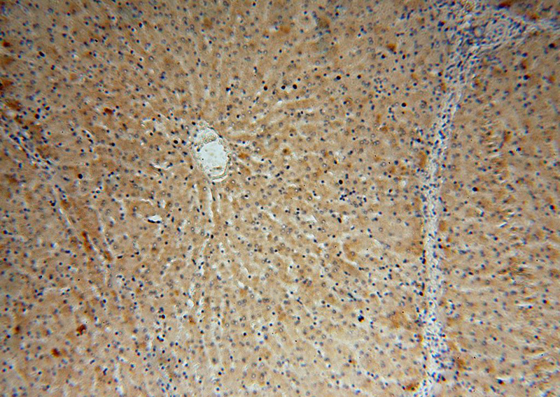 Immunohistochemical of paraffin-embedded human liver using Catalog No:110959(GGCX antibody) at dilution of 1:100 (under 10x lens)