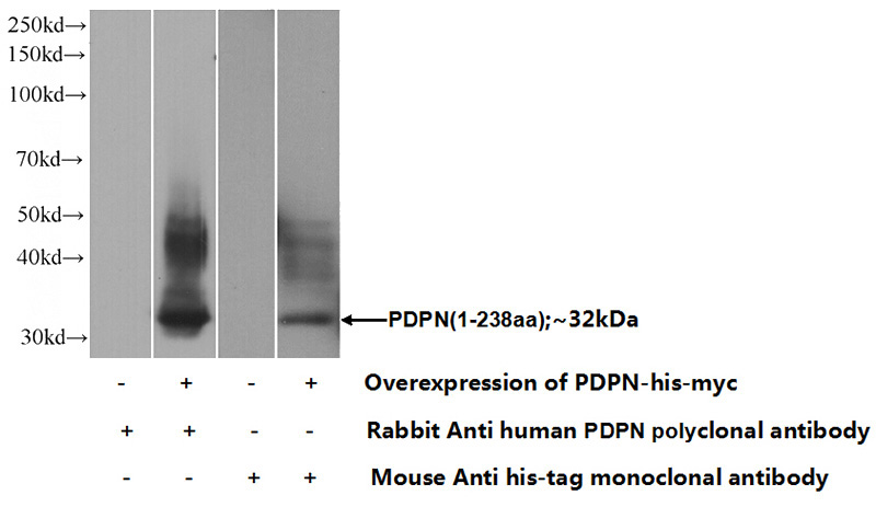 Transfected HEK-293 cells were subjected to SDS PAGE followed by western blot with Catalog No:113989(PDPN,D2-40,M2A Antibody) at dilution of 1:1000