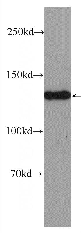 SMMC-7721 cells were subjected to SDS PAGE followed by western blot with Catalog No:113819(PHKA2 Antibody) at dilution of 1:600