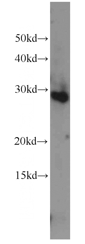 HeLa cells were subjected to SDS PAGE followed by western blot with Catalog No:109652(CXorf56 antibody) at dilution of 1:1000