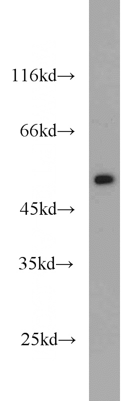 mouse brain tissue were subjected to SDS PAGE followed by western blot with Catalog No:110452(FAF2 antibody) at dilution of 1:1000