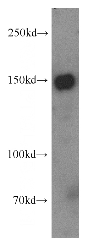 PC-3 cells were subjected to SDS PAGE followed by western blot with Catalog No:116375(TTBK2 antibody) at dilution of 1:400