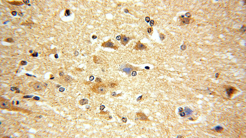 Immunohistochemical of paraffin-embedded human brain using Catalog No:112520(METTL5 antibody) at dilution of 1:100 (under 40x lens)