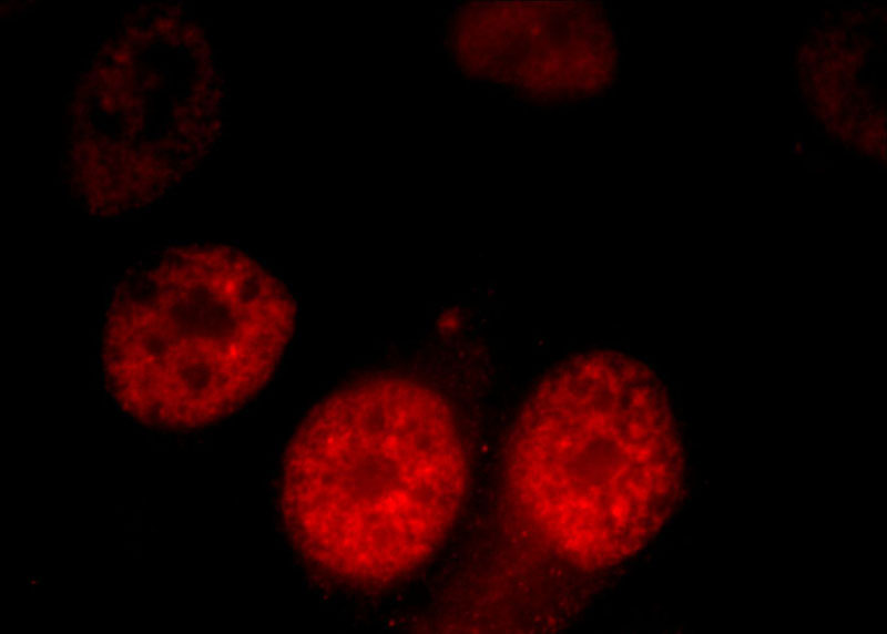 Immunofluorescent analysis of HepG2 cells, using KIAA1967 antibody Catalog No:108954 at 1:50 dilution and Rhodamine-labeled goat anti-rabbit IgG (red).