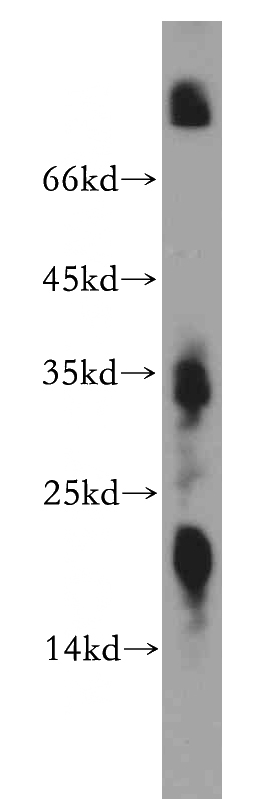 mouse kidney tissue were subjected to SDS PAGE followed by western blot with Catalog No:116950(ZNF146 antibody) at dilution of 1:600