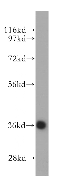 HEK-293 cells were subjected to SDS PAGE followed by western blot with Catalog No:109847(DEDD2 antibody) at dilution of 1:300