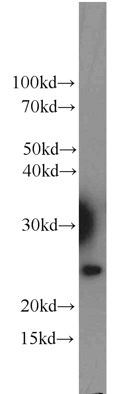 HeLa cells were subjected to SDS PAGE followed by western blot with Catalog No:114554(RBM8A,Y14 antibody) at dilution of 1:500