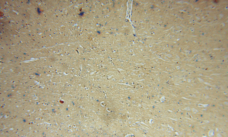 Immunohistochemical of paraffin-embedded human brain using Catalog No:113228(NQO2 antibody) at dilution of 1:100 (under 10x lens)
