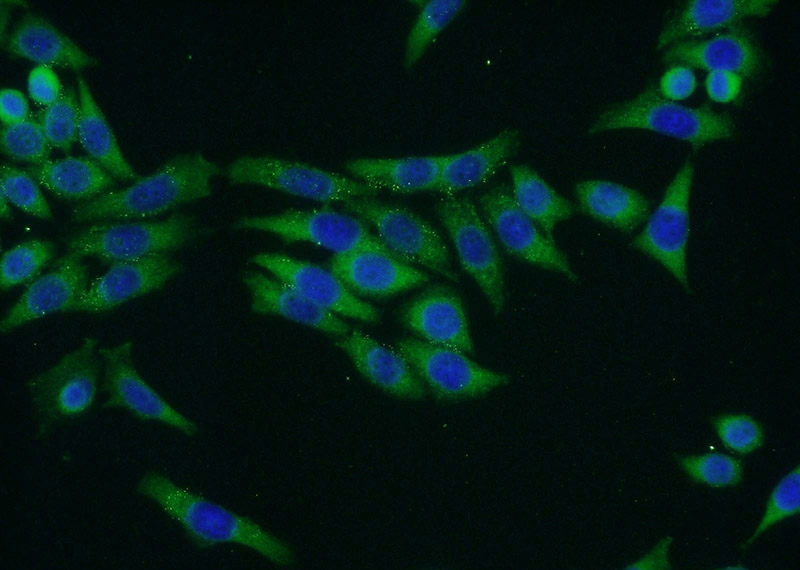 Immunofluorescent analysis of HeLa cells using Catalog No:116395(TRMT1 Antibody) at dilution of 1:50 and Alexa Fluor 488-congugated AffiniPure Goat Anti-Rabbit IgG(H+L)