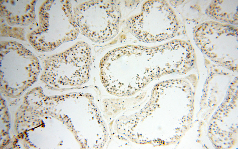 Immunohistochemical of paraffin-embedded human testis using Catalog No:115666(NCOA1 antibody) at dilution of 1:100 (under 10x lens)