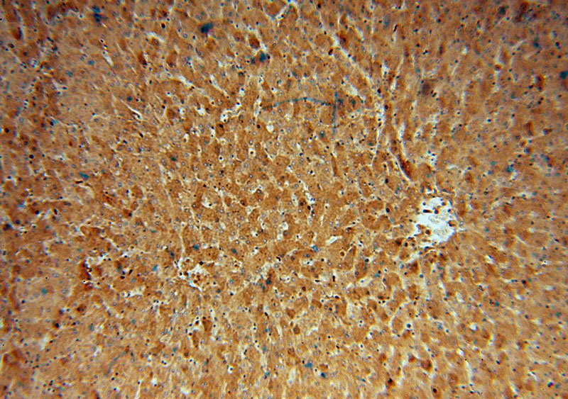 Immunohistochemical of paraffin-embedded human liver using Catalog No:107727(ACAT1 antibody) at dilution of 1:100 (under 10x lens)