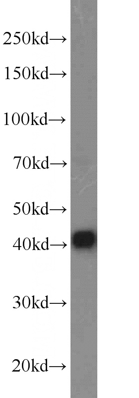 Jurkat cells were subjected to SDS PAGE followed by western blot with Catalog No:110092(DNAJB14 antibody) at dilution of 1:1500