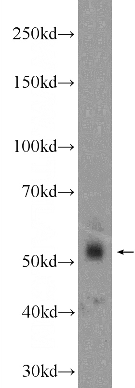 Jurkat cells were subjected to SDS PAGE followed by western blot with Catalog No:117025(ZNF71 Antibody) at dilution of 1:1000