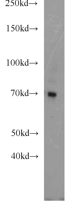 human placenta tissue were subjected to SDS PAGE followed by western blot with Catalog No:114219(PROS1 antibody) at dilution of 1:1000