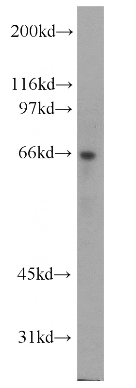 Jurkat cells were subjected to SDS PAGE followed by western blot with Catalog No:108281(ATE1 antibody) at dilution of 1:1000