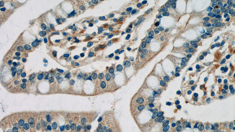 Immunohistochemistry of paraffin-embedded human small intestine tissue slide using Catalog No:116077(TLR7 Antibody) at dilution of 1:50 (under 40x lens)