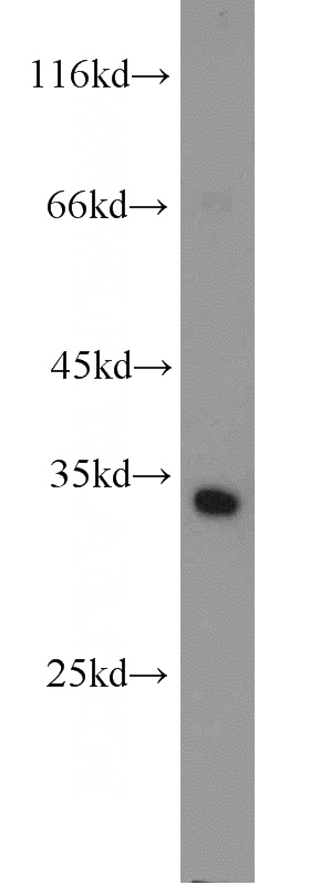 mouse testis tissue were subjected to SDS PAGE followed by western blot with Catalog No:113653(PDCL2 antibody) at dilution of 1:500