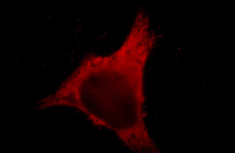 Immunofluorescent analysis of Hela cells, using LIMA1 antibody Catalog No: at 1:50 dilution and Rhodamine-labeled goat anti-mouse IgG (red).