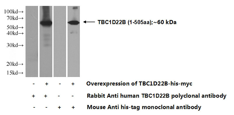 Transfected HEK-293 cells were subjected to SDS PAGE followed by western blot with Catalog No:115865(TBC1D22B Antibody) at dilution of 1:500