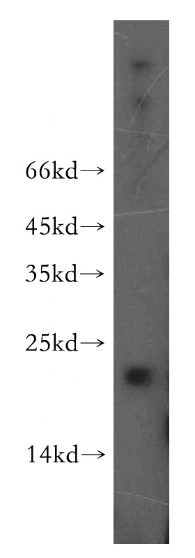 mouse pancreas tissue were subjected to SDS PAGE followed by western blot with Catalog No:108133(ANAPC11 antibody) at dilution of 1:400