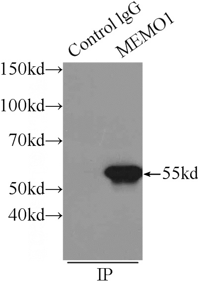 IP Result of anti-MEMO1 (IP:Catalog No:112652, 3ug; Detection:Catalog No:112652 1:500) with MCF-7 cells lysate 1000ug.