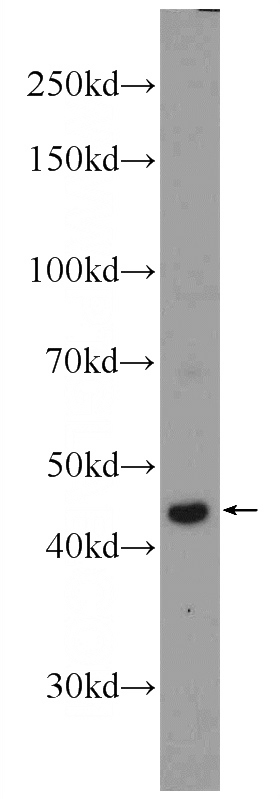 mouse thymus tissue were subjected to SDS PAGE followed by western blot with Catalog No:114929(RRP7A Antibody) at dilution of 1:1000