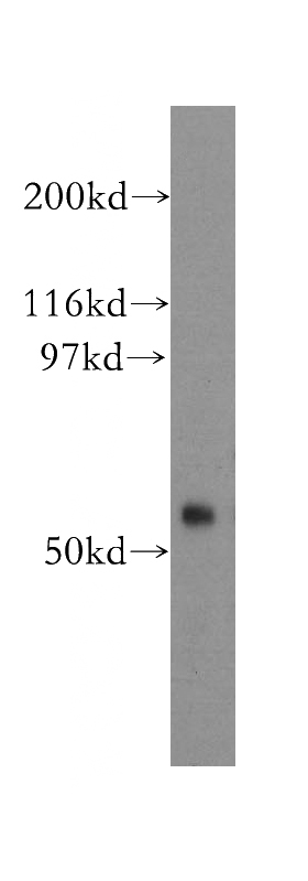 A2780 cells were subjected to SDS PAGE followed by western blot with Catalog No:110540(FBXO15 antibody) at dilution of 1:1500