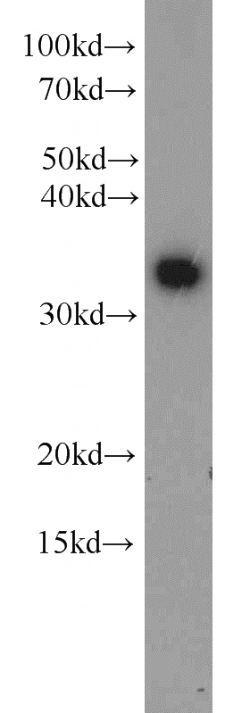 mouse liver tissue were subjected to SDS PAGE followed by western blot with Catalog No:116814(WDR61 antibody) at dilution of 1:1000