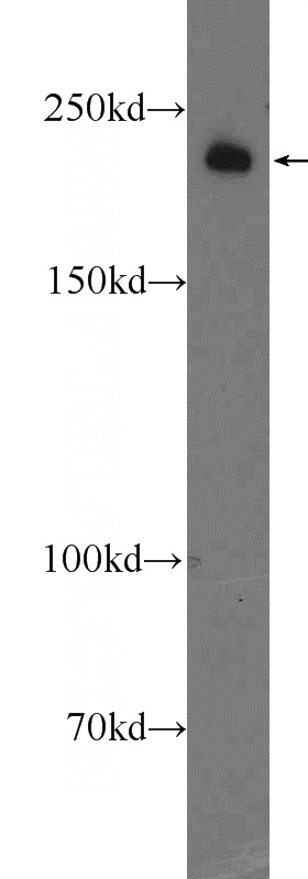 PC-3 cells were subjected to SDS PAGE followed by western blot with Catalog No:111992(KIAA1429 Antibody) at dilution of 1:600