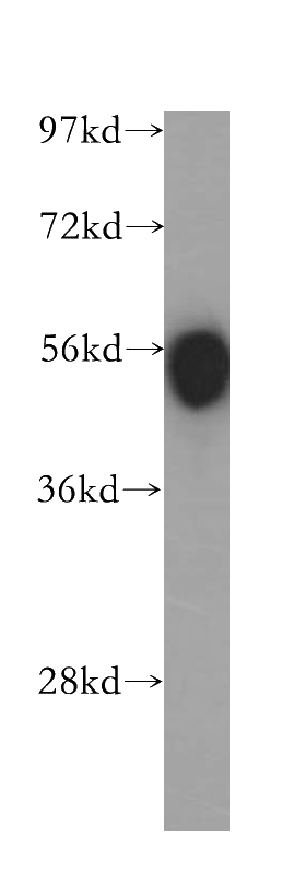 human spleen tissue were subjected to SDS PAGE followed by western blot with Catalog No:109035(CD4 antibody) at dilution of 1:300