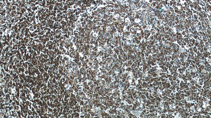 Immunohistochemistry of paraffin-embedded human tonsillitis tissue slide using Catalog No:115911(TCL1A Antibody) at dilution of 1:50 (under 10x lens)