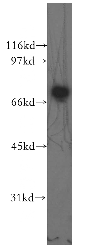 human placenta tissue were subjected to SDS PAGE followed by western blot with Catalog No:109985(DLAT antibody) at dilution of 1:1000