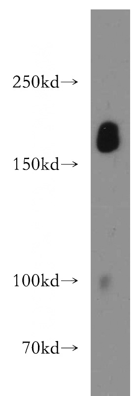 human placenta tissue were subjected to SDS PAGE followed by western blot with Catalog No:114181(PZP antibody) at dilution of 1:800