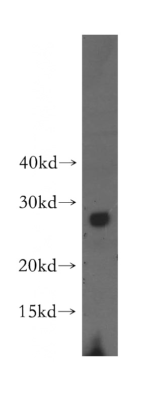 HEK-293 cells were subjected to SDS PAGE followed by western blot with Catalog No:116775(VPS24 antibody) at dilution of 1:300