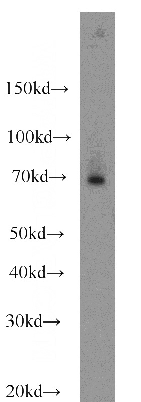 HepG2 cells were subjected to SDS PAGE followed by western blot with Catalog No:110617(FEM1C antibody) at dilution of 1:1000