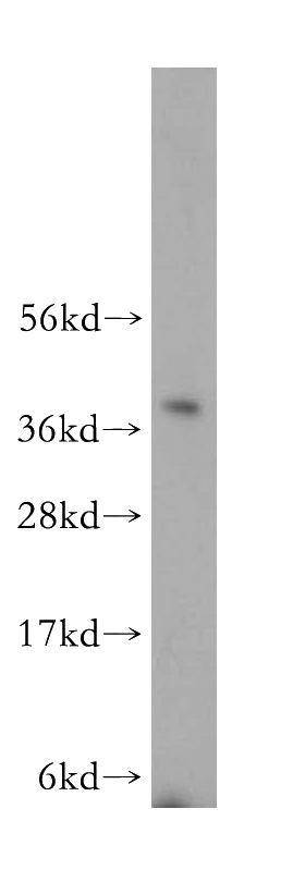 HeLa cells were subjected to SDS PAGE followed by western blot with Catalog No:114824(RPP40 antibody) at dilution of 1:400