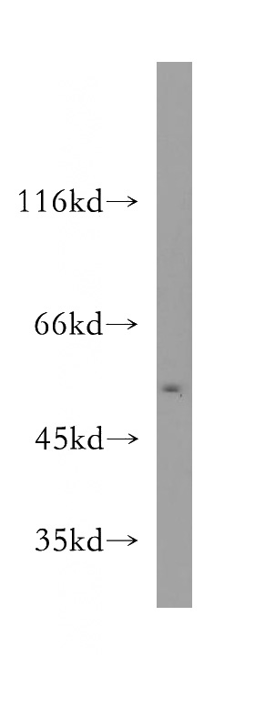 BxPC-3 cells were subjected to SDS PAGE followed by western blot with Catalog No:115435(SMARCD3 antibody) at dilution of 1:400