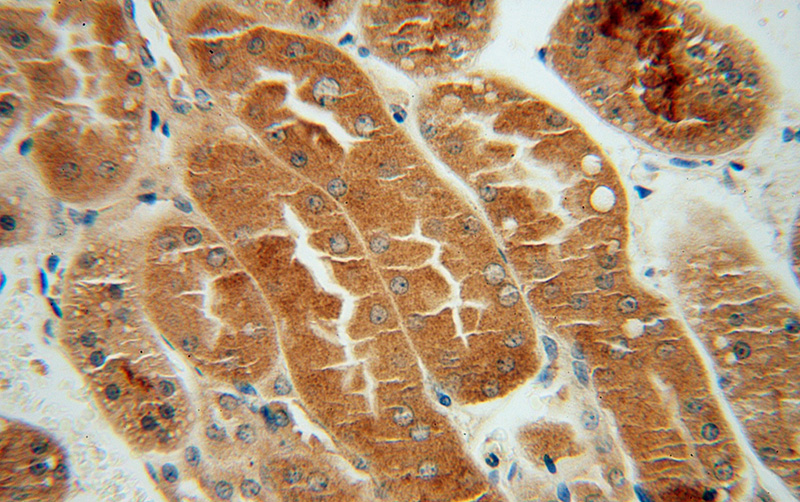 Immunohistochemical of paraffin-embedded human kidney using Catalog No:109237(CHMP7 antibody) at dilution of 1:100 (under 40x lens)