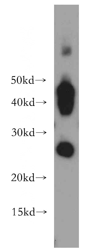 human skeletal muscle tissue were subjected to SDS PAGE followed by western blot with Catalog No:108045(AQP1 antibody) at dilution of 1:1000