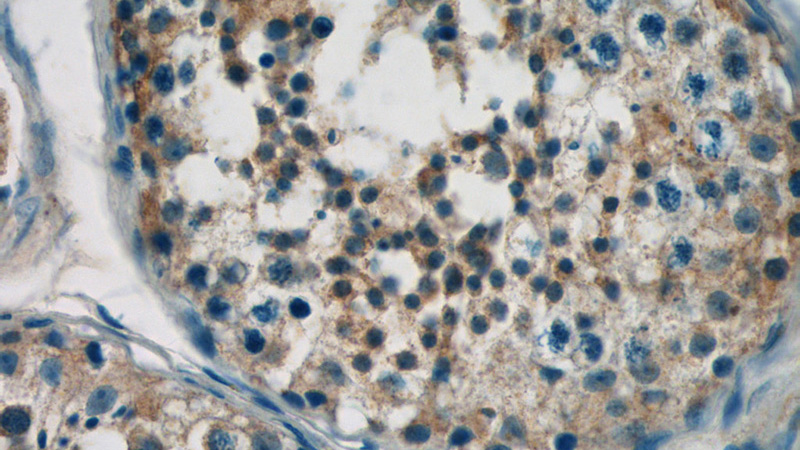 Immunohistochemistry of paraffin-embedded human testis tissue slide using Catalog No:109307(CIAO1 Antibody) at dilution of 1:50 (under 40x lens)