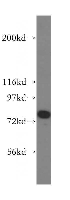 mouse trachea tissue were subjected to SDS PAGE followed by western blot with Catalog No:115789(SNPH antibody) at dilution of 1:800