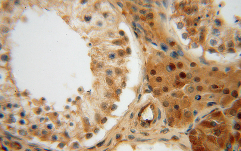 Immunohistochemical of paraffin-embedded human testis using Catalog No:112521(METTL6 antibody) at dilution of 1:50 (under 40x lens)