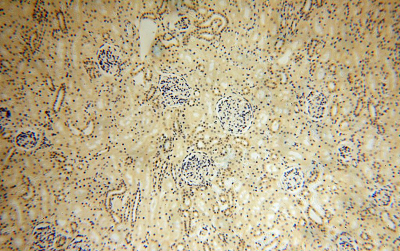 Immunohistochemical of paraffin-embedded human kidney using Catalog No:115868(TBC1D5 antibody) at dilution of 1:100 (under 10x lens)