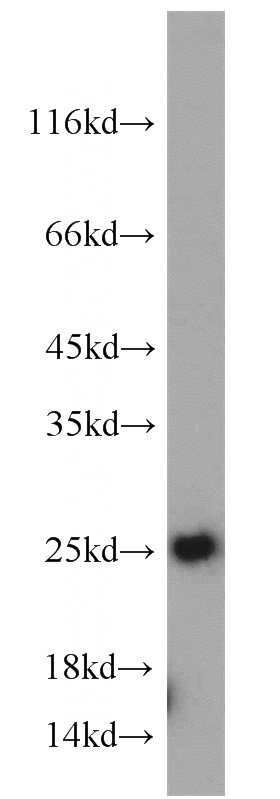 mouse placenta tissue were subjected to SDS PAGE followed by western blot with Catalog No:116220(TPT1 antibody) at dilution of 1:800
