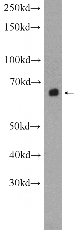 mouse liver tissue were subjected to SDS PAGE followed by western blot with Catalog No:107701(ACSM5 Antibody) at dilution of 1:300